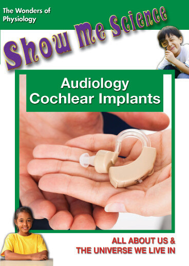 K4657 - Audiology Cochlear Implants